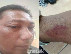 DPD PJS Sumut Desak Polisi Tangkap Pelaku Penganiayaan Wartawan di Toba